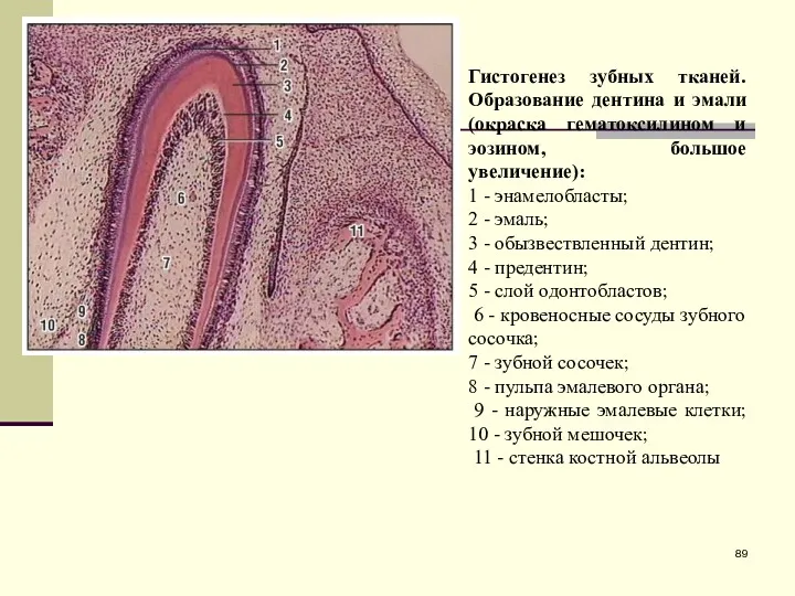 Гистогенез зубных тканей. Образование дентина и эмали (окраска гематоксилином и