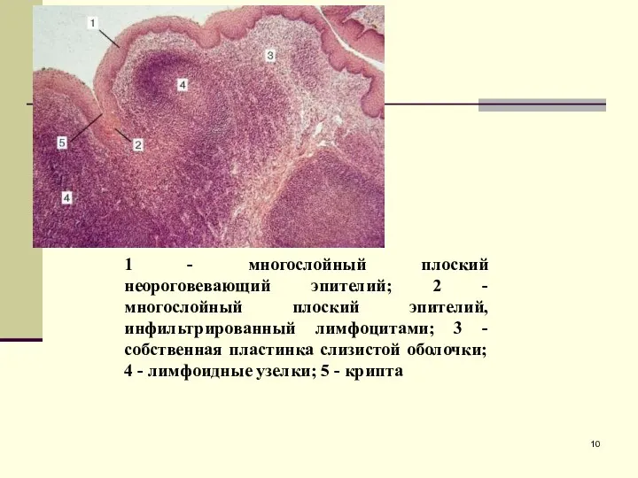 1 - многослойный плоский неороговевающий эпителий; 2 - многослойный плоский