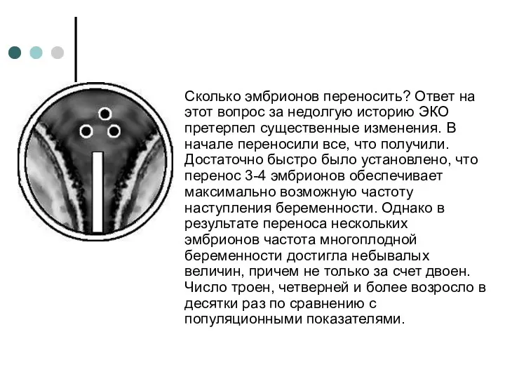 Сколько эмбрионов переносить? Ответ на этот вопрос за недолгую историю