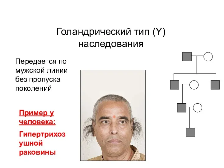 Голандрический тип (Y) наследования Передается по мужской линии без пропуска