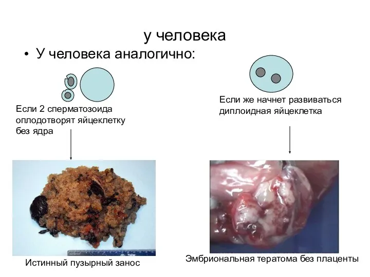 у человека У человека аналогично: Если 2 сперматозоида оплодотворят яйцеклетку