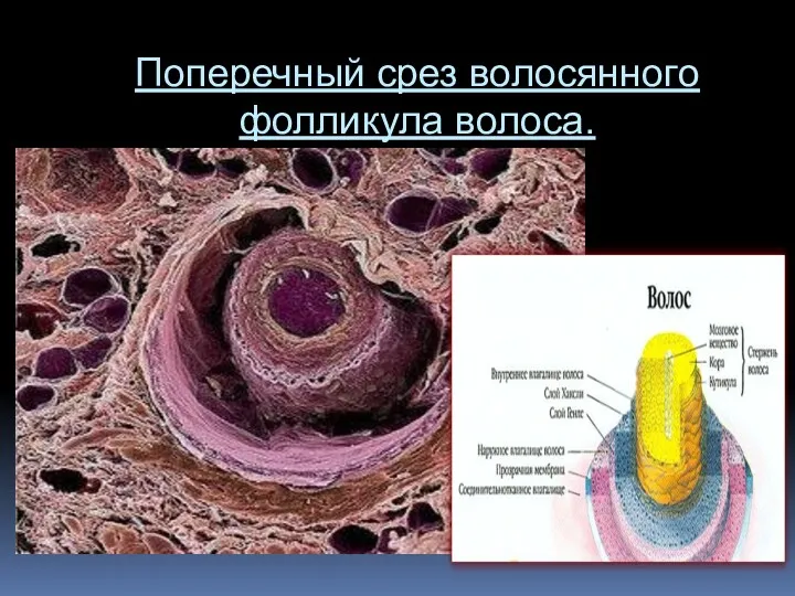 Поперечный срез волосянного фолликула волоса.