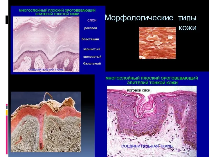 Морфологические типы кожи