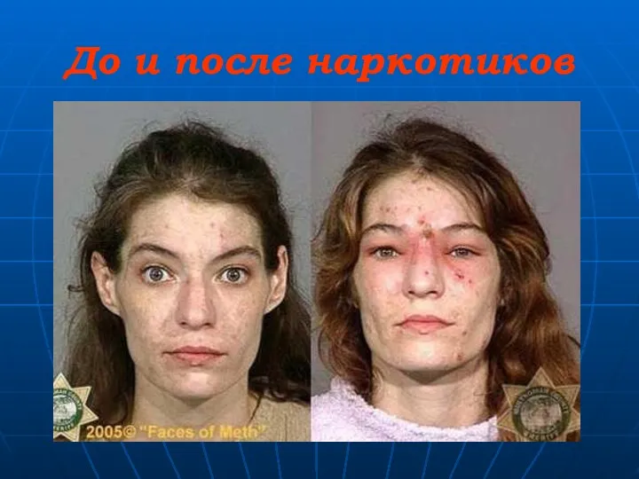 До и после наркотиков