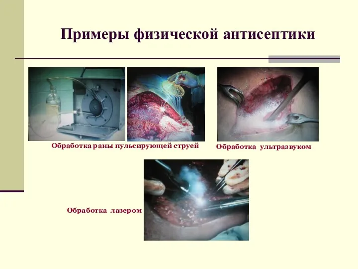 Примеры физической антисептики