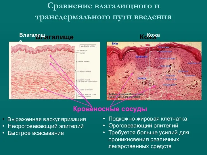 Сравнение влагалищного и трансдермального пути введения Влагалище Кожа Кровеносные сосуды
