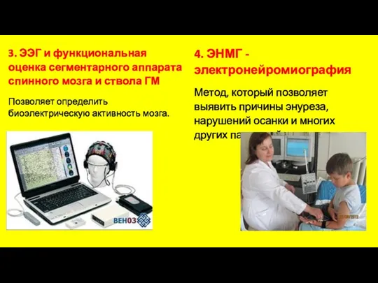 3. ЭЭГ и функциональная оценка сегментарного аппарата спинного мозга и