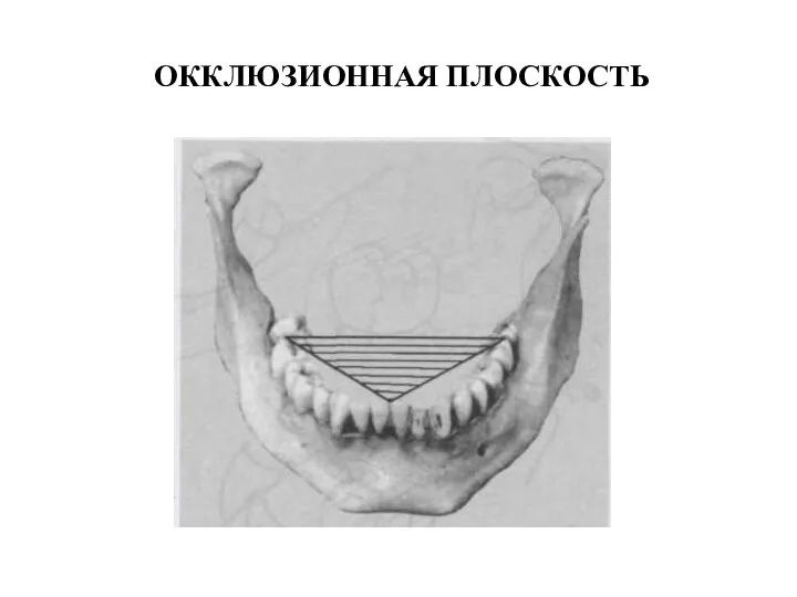 ОККЛЮЗИОННАЯ ПЛОСКОСТЬ