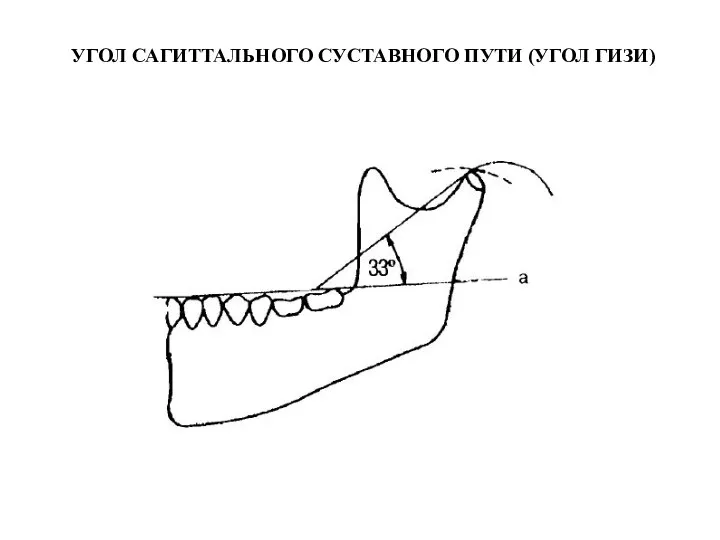 УГОЛ САГИТТАЛЬНОГО СУСТАВНОГО ПУТИ (УГОЛ ГИЗИ)