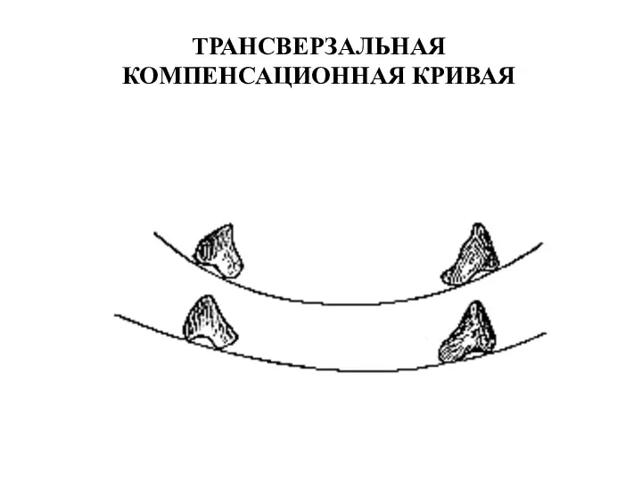 ТРАНСВЕРЗАЛЬНАЯ КОМПЕНСАЦИОННАЯ КРИВАЯ