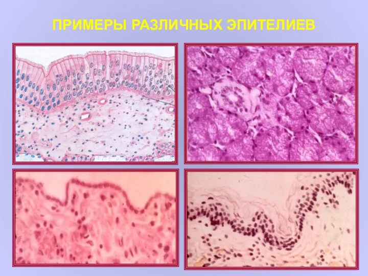 ПРИМЕРЫ РАЗЛИЧНЫХ ЭПИТЕЛИЕВ