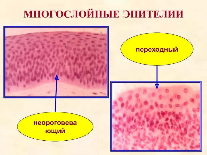 МНОГОСЛОЙНЫЕ ЭПИТЕЛИИ неороговевающий переходный