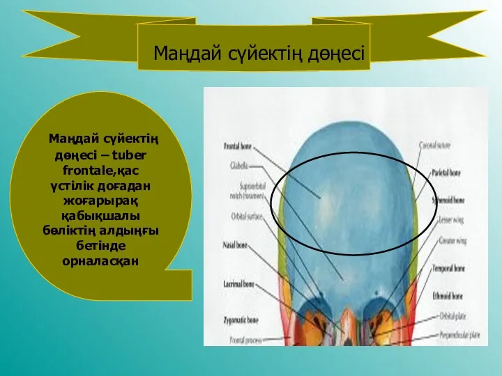 . Маңдай сүйектің дөңесі Маңдай сүйектің дөңесі – tuber frontale,қас