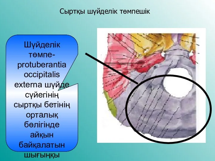 Сыртқы шүйделік төмпешік Шүйделік төмпе- protuberantia occipitalis externa шүйде сүйегінің