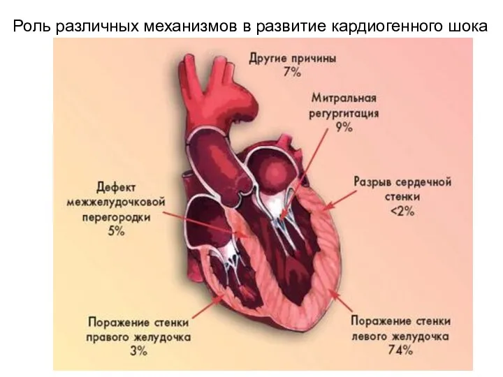 Роль различных механизмов в развитие кардиогенного шока