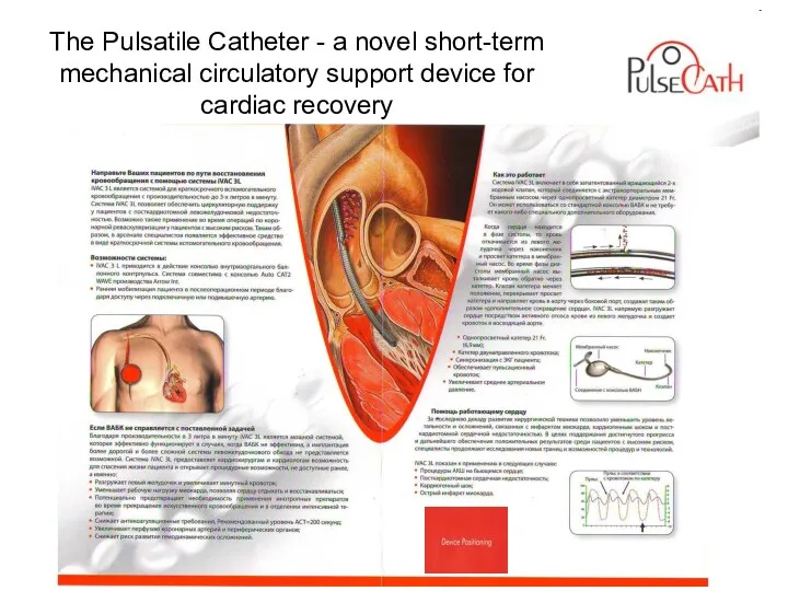 The Pulsatile Catheter - a novel short-term mechanical circulatory support device for cardiac recovery