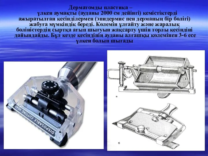 Дерматомды пластика – үлкен аумақты (ауданы 2000 см дейінгі) кемістіктерді ажыратылған кесінділермен (эпидермис
