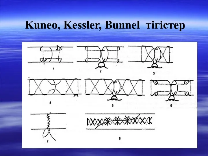 Kuneo, Kessler, Bunnel тігістер