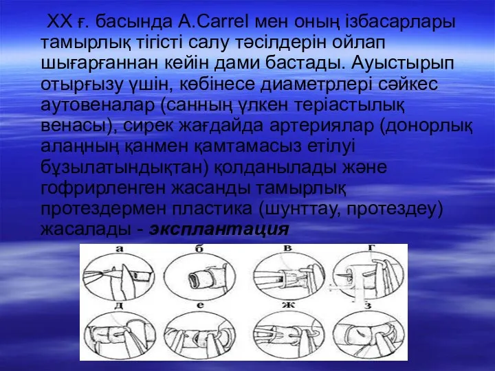 ХХ ғ. басында А.Carrel мен оның ізбасарлары тамырлық тігісті салу тәсілдерін ойлап шығарғаннан