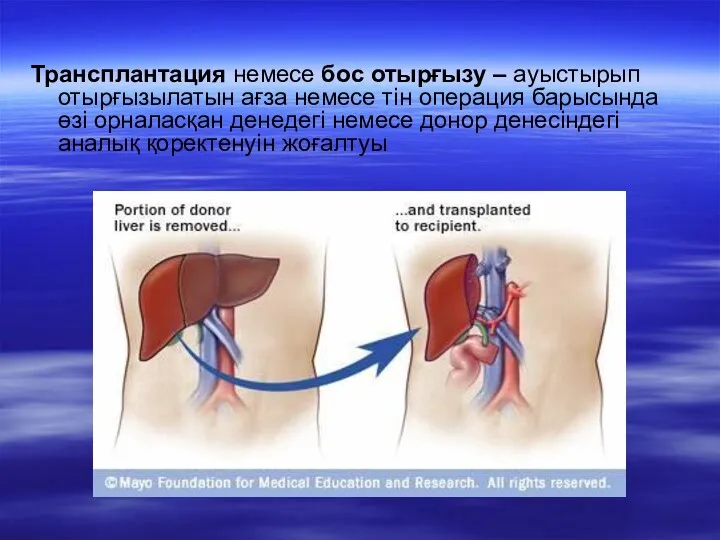 Трансплантация немесе бос отырғызу – ауыстырып отырғызылатын ағза немесе тін операция барысында өзі