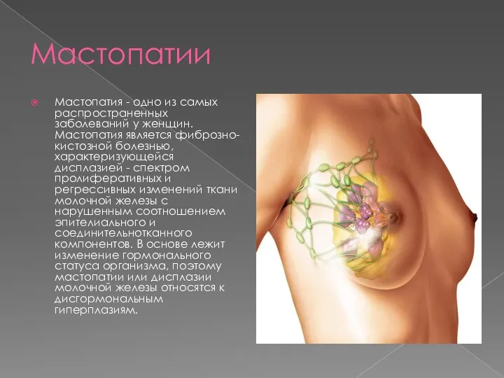 Мастопатии Мастопатия - одно из самых распространенных заболеваний у женщин.