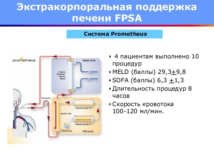 4 пациентам выполнено 10 процедур MELD (баллы) 29,3+9,8 SOFA (баллы)