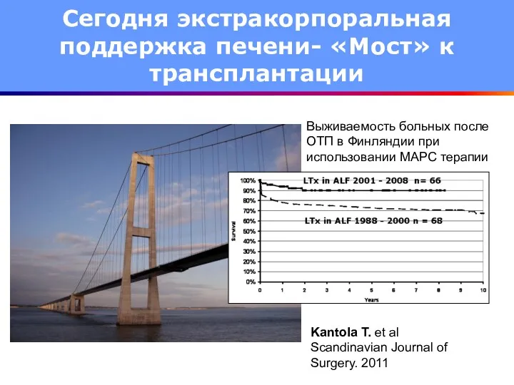 Сегодня экстракорпоральная поддержка печени- «Мост» к трансплантации Выживаемость больных после