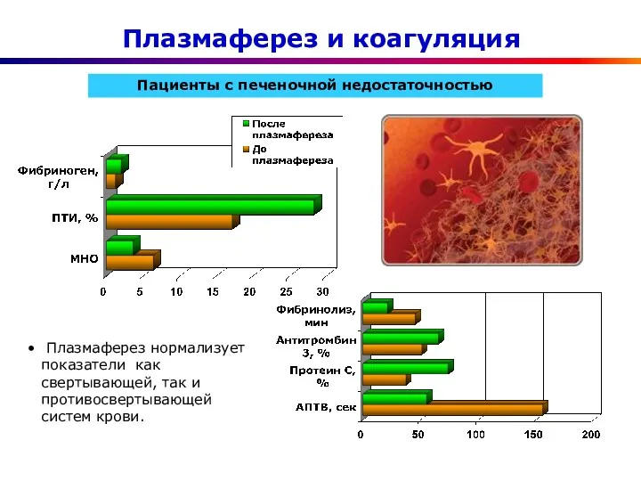 Плазмаферез и коагуляция Пациенты с печеночной недостаточностью Плазмаферез нормализует показатели