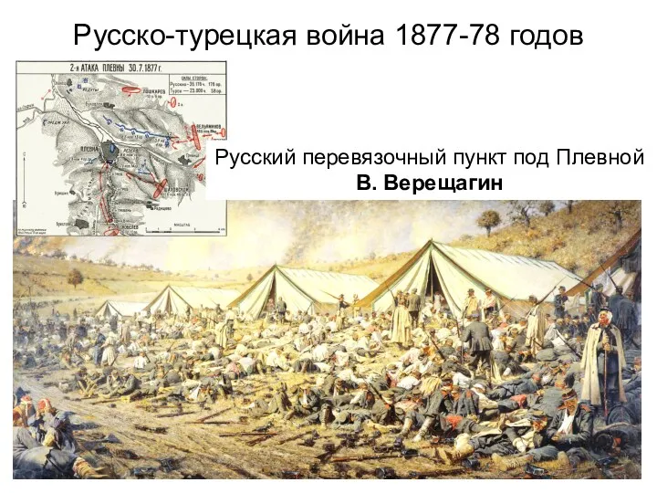 Русско-турецкая война 1877-78 годов Русский перевязочный пункт под Плевной В. Верещагин