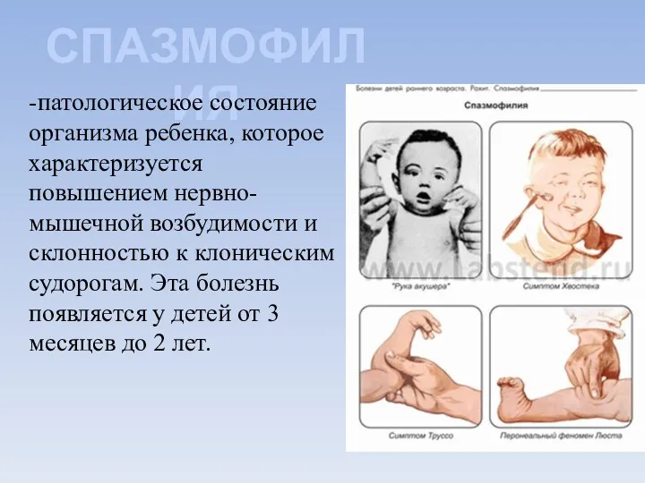 СПАЗМОФИЛИЯ -патологическое состояние организма ребенка, которое характеризуется повышением нервно-мышечной возбудимости