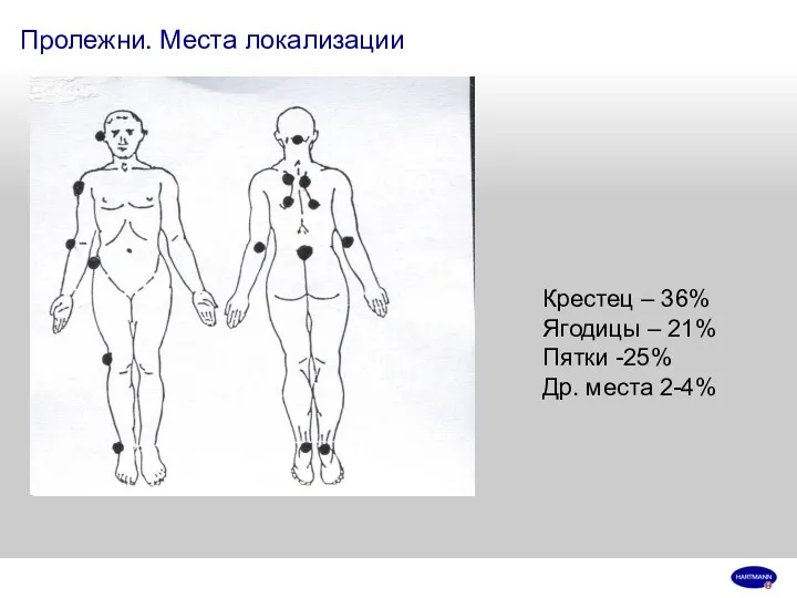 Пролежни. Места локализации Крестец – 36% Ягодицы – 21% Пятки -25% Др. места 2-4%