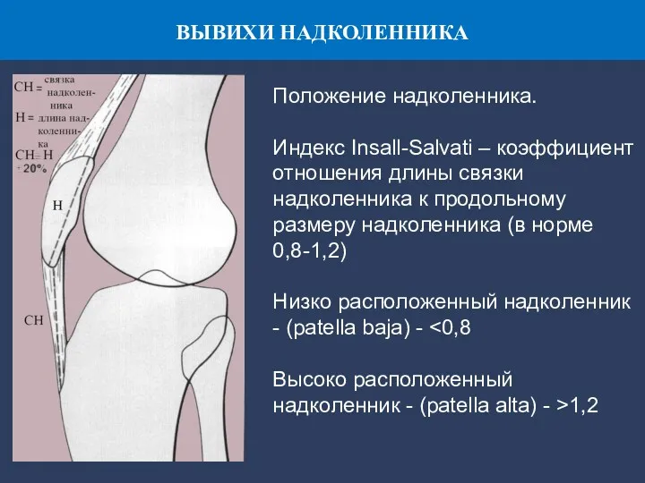 ВЫВИХИ НАДКОЛЕННИКА Положение надколенника. Индекс Insall-Salvati – коэффициент отношения длины