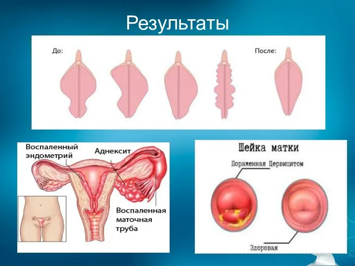 Результаты