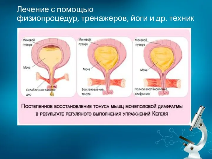 Лечение с помощью физиопроцедур, тренажеров, йоги и др. техник