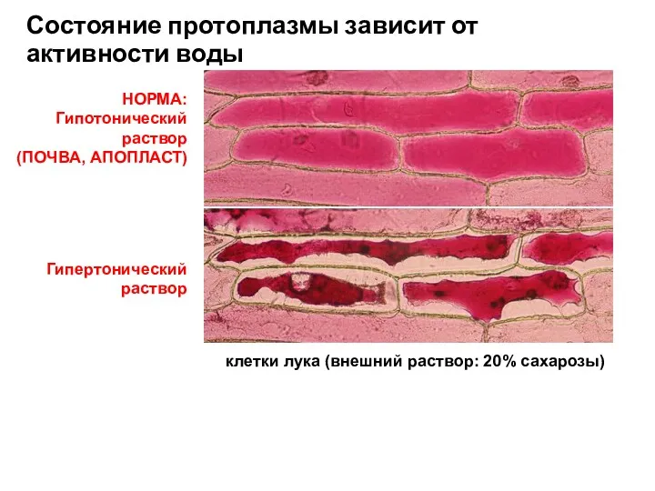 Гипертонический раствор Состояние протоплазмы зависит от активности воды НОРМА: Гипотонический