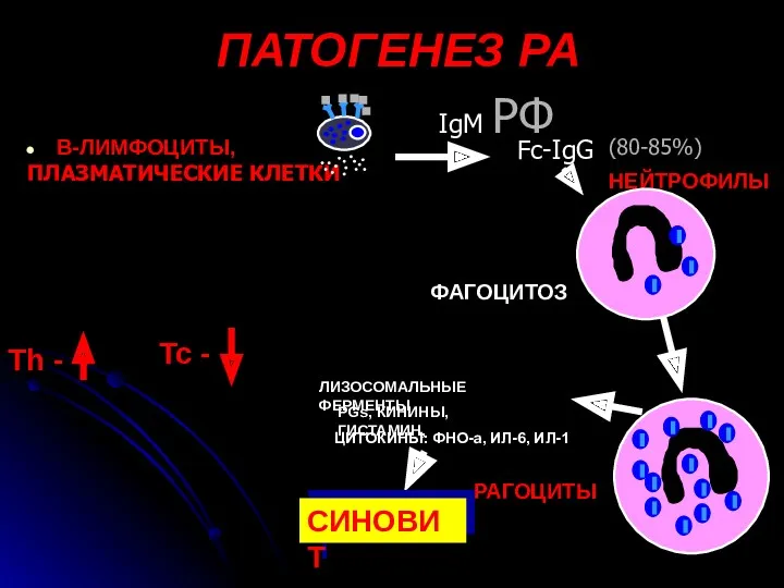 ПАТОГЕНЕЗ РА В-ЛИМФОЦИТЫ, Fc-IgG IgM РФ ПЛАЗМАТИЧЕСКИЕ КЛЕТКИ НЕЙТРОФИЛЫ ФАГОЦИТОЗ