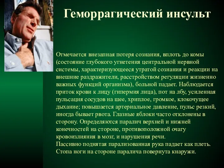 Геморрагический инсульт Отмечается внезапная потеря сознания, вплоть до комы (состояние