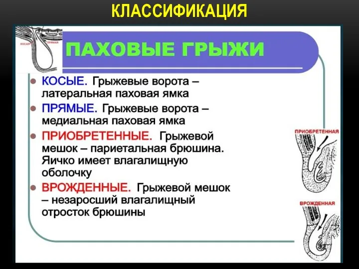 КЛАССИФИКАЦИЯ