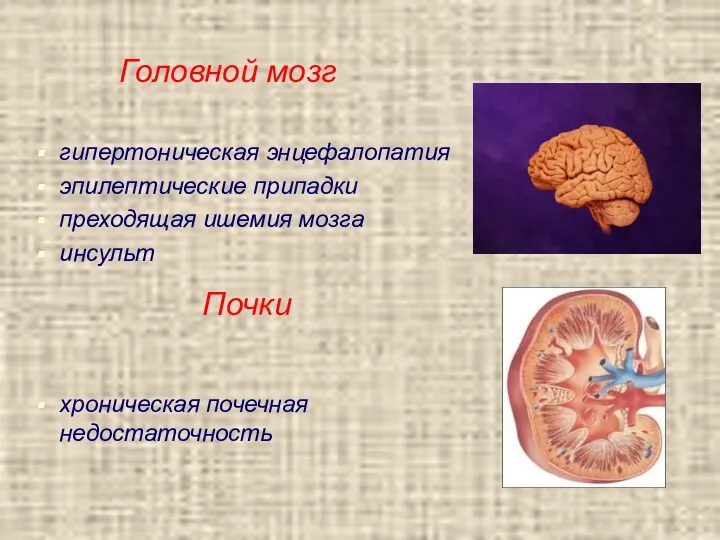 Головной мозг гипертоническая энцефалопатия эпилептические припадки преходящая ишемия мозга инсульт хроническая почечная недостаточность Почки