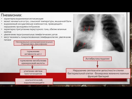 Пневмония: характерна выраженная интоксикация может начинаться остро, с высокой температуры,