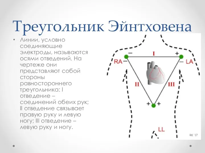 Треугольник Эйнтховена Линии, условно соединяющие электроды, называются осями отведений. На