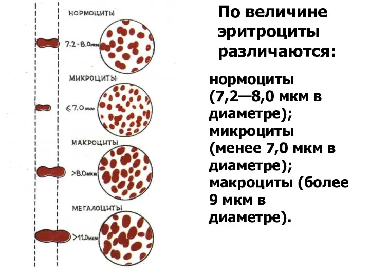 По величине эритроциты различаются: нормоциты (7,2—8,0 мкм в диаметре); микроциты