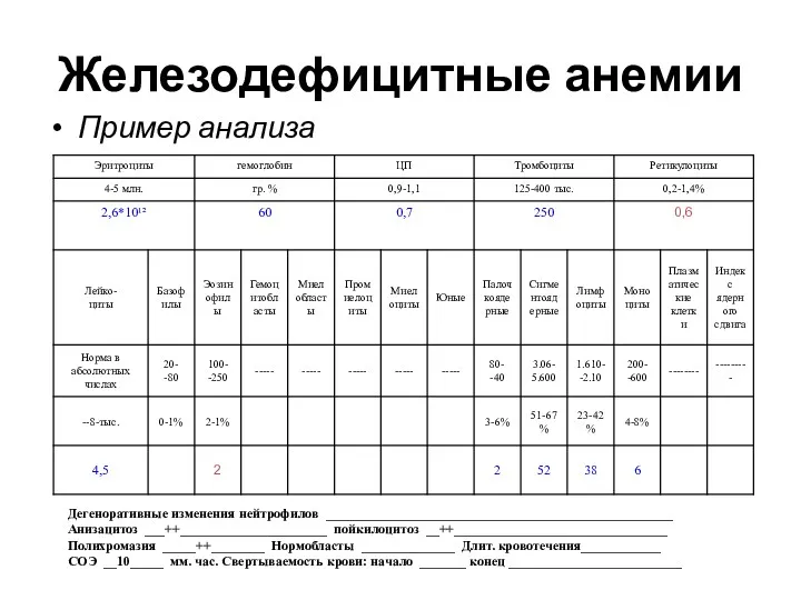 Железодефицитные анемии Пример анализа Дегеноративные изменения нейтрофилов ____________________________________________________ Анизацитоз ___++______________________ пойкилоцитоз __++________________________________ Полихромазия