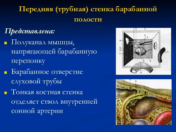 Передняя (трубная) стенка барабанной полости Представлена: Полуканал мышцы, напрягающей барабанную