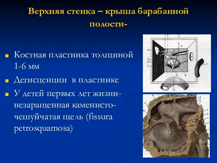 Верхняя стенка – крыша барабанной полости- Костная пластинка толщиной 1-6