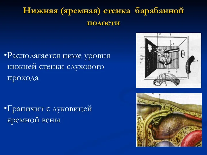 Нижняя (яремная) стенка барабанной полости Располагается ниже уровня нижней стенки