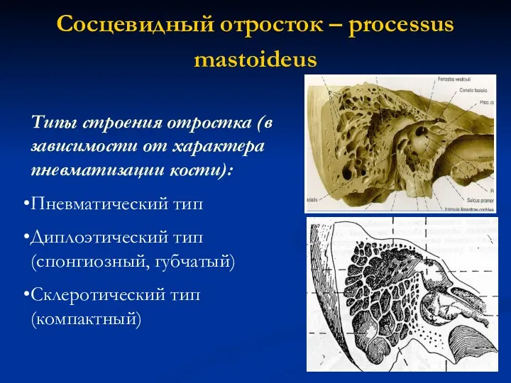 Сосцевидный отросток – processus mastoideus Типы строения отростка (в зависимости