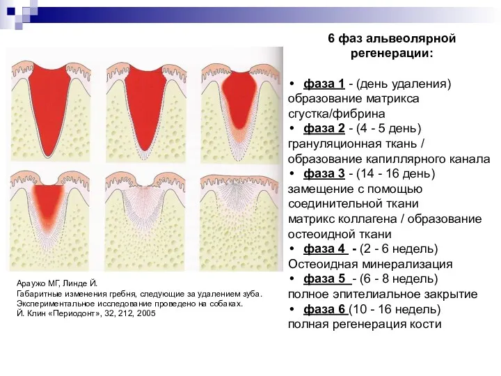 Постэкстракционные зубные лунки Коллаген 6 фаз альвеолярной регенерации: фаза 1