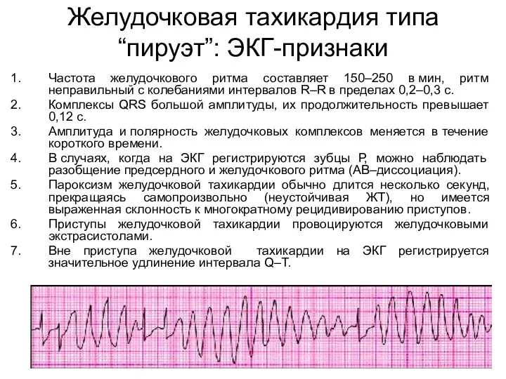 Желудочковая тахикардия типа “пируэт”: ЭКГ-признаки Частота желудочкового ритма составляет 150–250 в мин, ритм