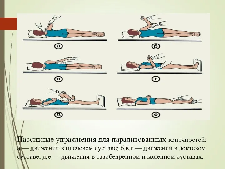 Пассивные упражнения для парализованных конечностей: а — движения в плечевом